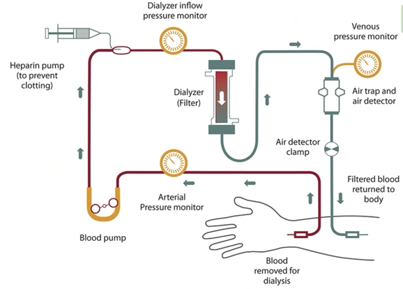 Hemodialysis cartoon