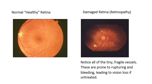 Combined Retina Images